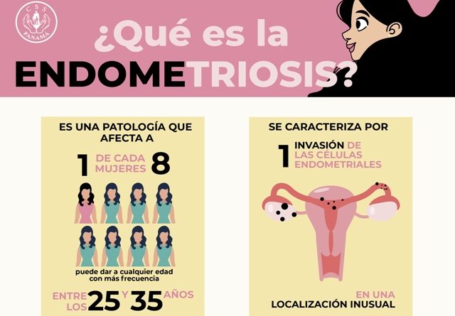 Endometriosis ¿qué Es Y Cómo Afecta La Vida De La Mujer El Digital Panamá 3062